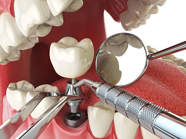 Best Urgent Tooth Repair  in Ephrata, PA