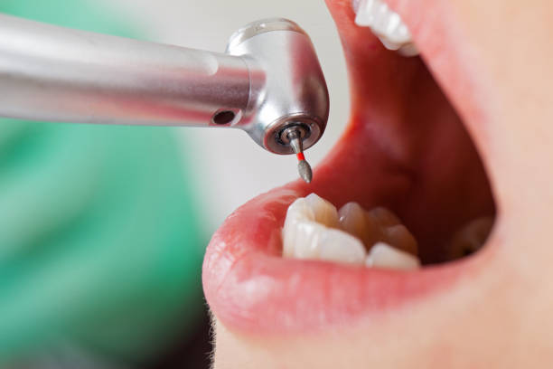 Urgent Tooth Repair in PA